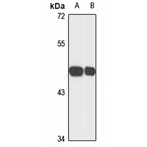 TIAR Rabbit Polyclonal Antibody