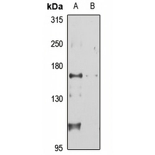 TIAM1 Rabbit Polyclonal Antibody