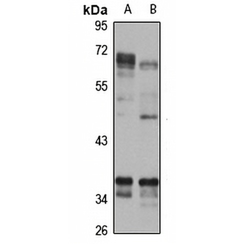 TRAM Rabbit Polyclonal Antibody