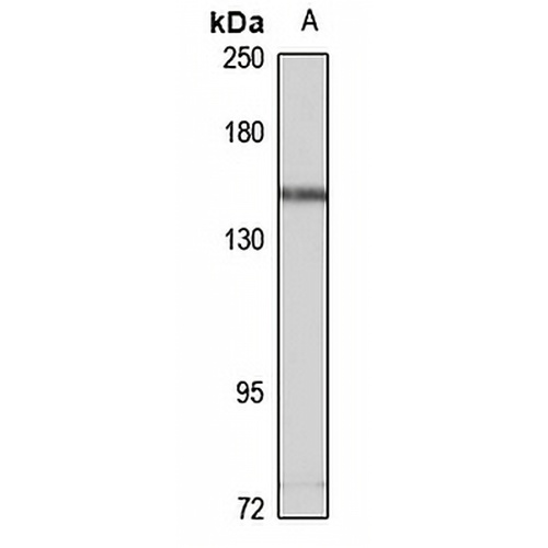 Timeless Rabbit Polyclonal Antibody