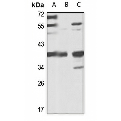 Tim50 Rabbit Polyclonal Antibody