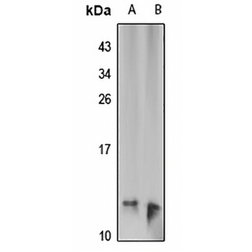 Tim9 Rabbit Polyclonal Antibody