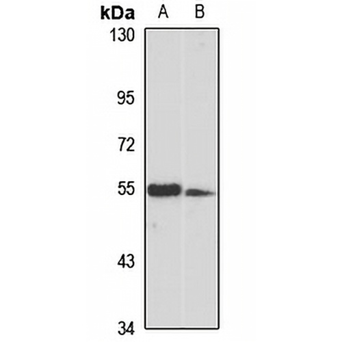 TINAGL1 Rabbit Polyclonal Antibody
