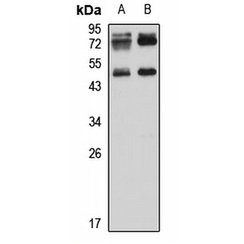 TIPIN Rabbit Polyclonal Antibody