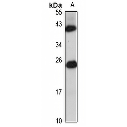 TMED3 Rabbit Polyclonal Antibody