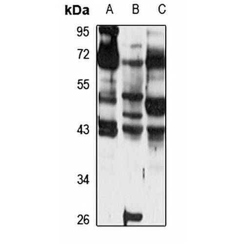 TMEFF2 Rabbit Polyclonal Antibody