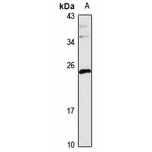 TMEM11 Rabbit Polyclonal Antibody