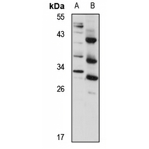 TMEM176B Rabbit Polyclonal Antibody