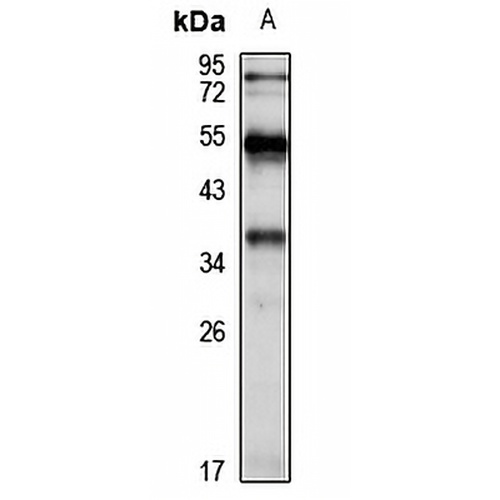 TMEM74 Rabbit Polyclonal Antibody