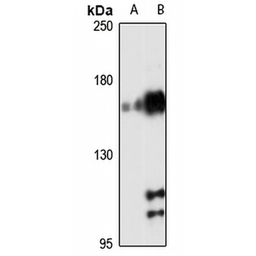 ARA160 Rabbit Polyclonal Antibody