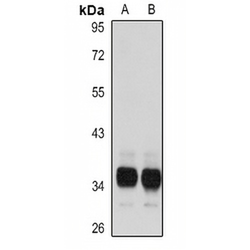 TMX1 Rabbit Polyclonal Antibody