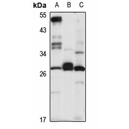 CD263 Rabbit Polyclonal Antibody