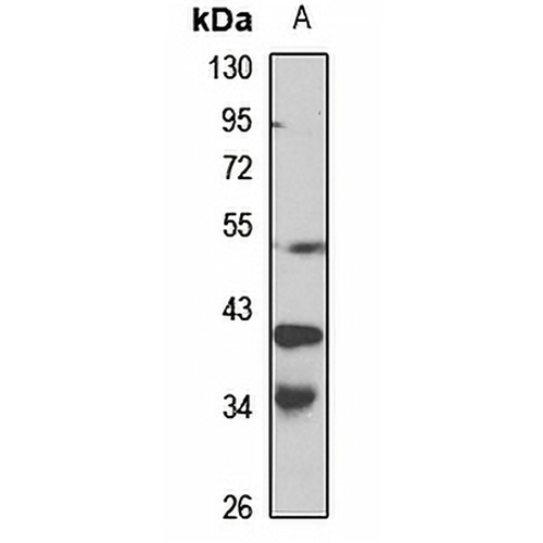 DCR3 Rabbit Polyclonal Antibody
