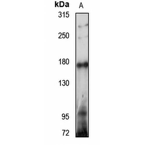 Tankyrase Rabbit Polyclonal Antibody