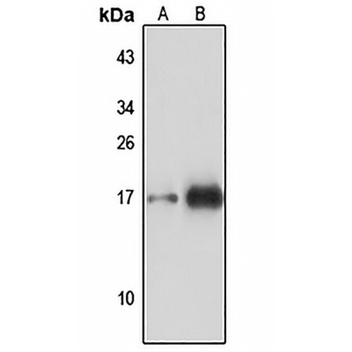 TOM22 Rabbit Polyclonal Antibody