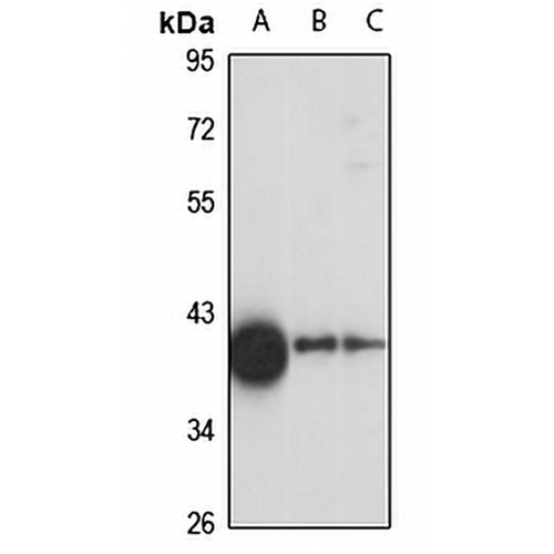 TOM40 Rabbit Polyclonal Antibody