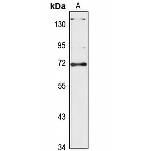 TOP1MT Rabbit Polyclonal Antibody