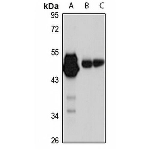 p53 Rabbit Polyclonal Antibody