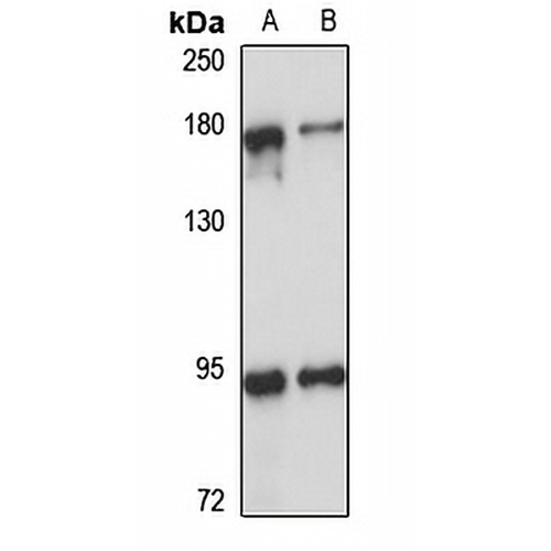 53BP2 Rabbit Polyclonal Antibody