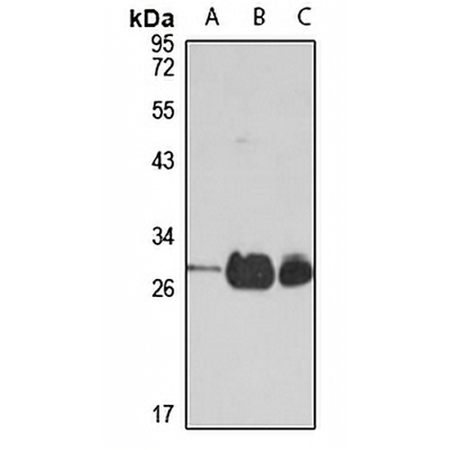 TPK1 Rabbit Polyclonal Antibody