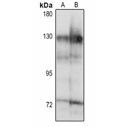 TRAK1 Rabbit Polyclonal Antibody