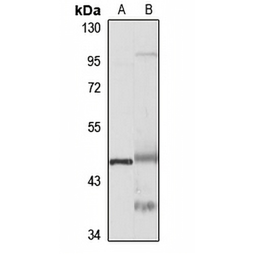 TRAM1 Rabbit Polyclonal Antibody
