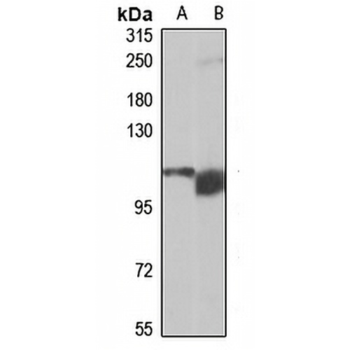 TRAPPC10 Rabbit Polyclonal Antibody