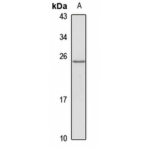 TREM2 Rabbit Polyclonal Antibody