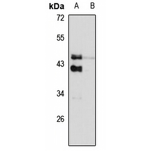 TRIB2 Rabbit Polyclonal Antibody