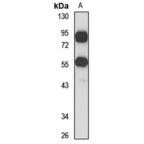 TRIM17 Rabbit Polyclonal Antibody