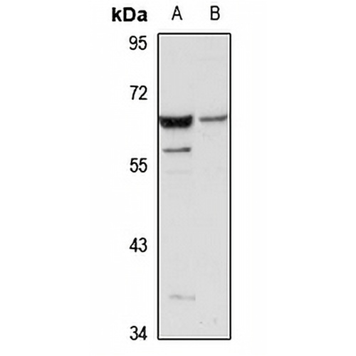 TRIM27 Rabbit Polyclonal Antibody