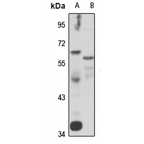 TRIM27 Rabbit Polyclonal Antibody