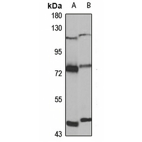 TRIM32 Rabbit Polyclonal Antibody
