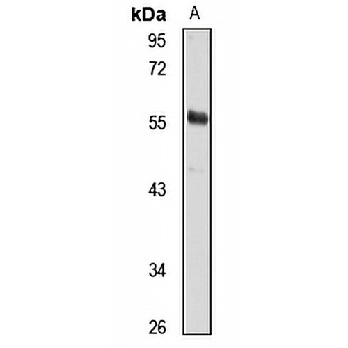 TRIM4 Rabbit Polyclonal Antibody