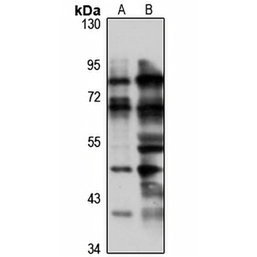 TRIM43 Rabbit Polyclonal Antibody