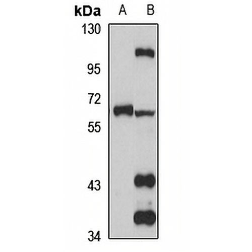TRIM45 Rabbit Polyclonal Antibody