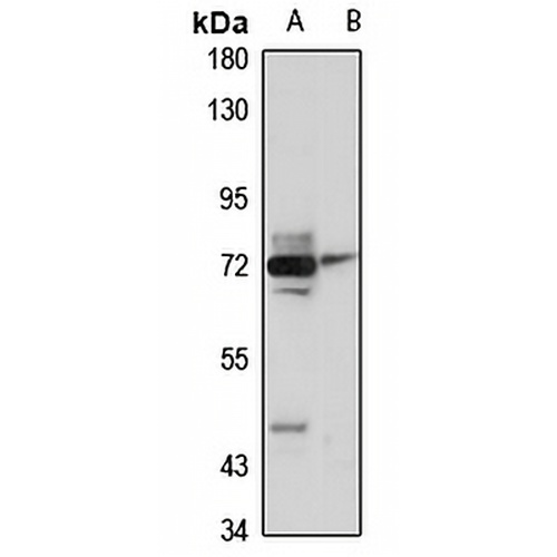 TRIM47 Rabbit Polyclonal Antibody