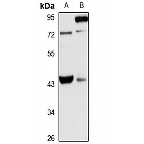 TRIM54 Rabbit Polyclonal Antibody