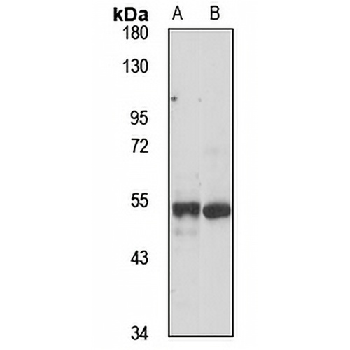 TRIM62 Rabbit Polyclonal Antibody
