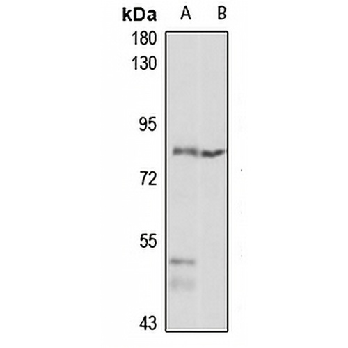 TRMT1 Rabbit Polyclonal Antibody