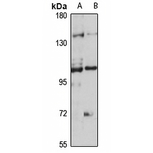 TRPC7 Rabbit Polyclonal Antibody