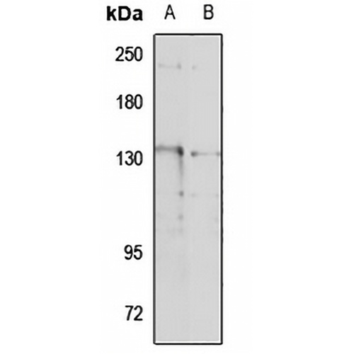 TRPM4 Rabbit Polyclonal Antibody