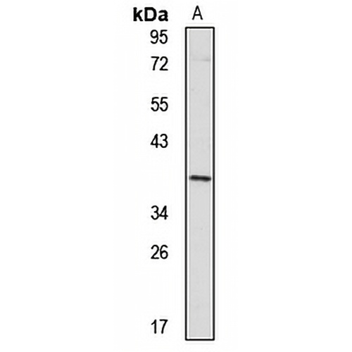 TRUB2 Rabbit Polyclonal Antibody