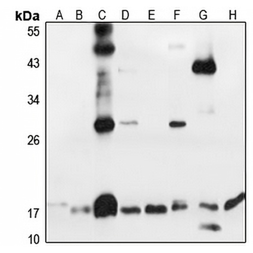 Thyrotropin beta Rabbit Polyclonal Antibody
