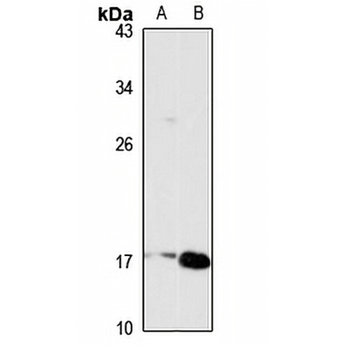 TSLP Rabbit Polyclonal Antibody