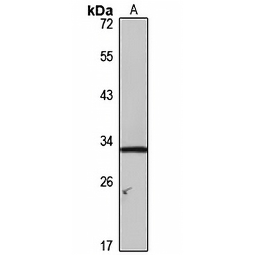 NET-7 Rabbit Polyclonal Antibody