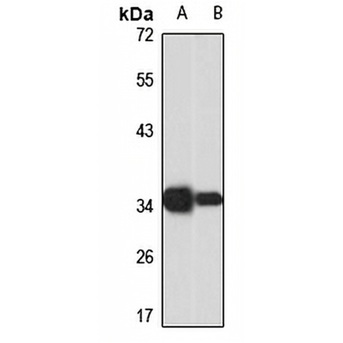 TSPY3 Rabbit Polyclonal Antibody