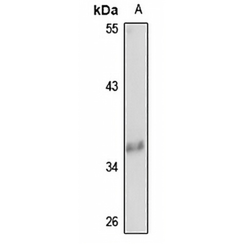 TTC1 Rabbit Polyclonal Antibody