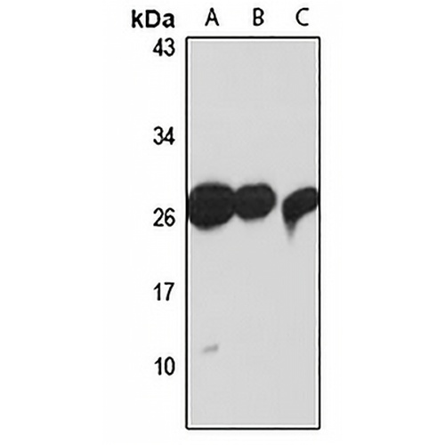 TXNDC9 Rabbit Polyclonal Antibody