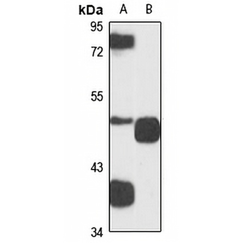 VDUP1 Rabbit Polyclonal Antibody